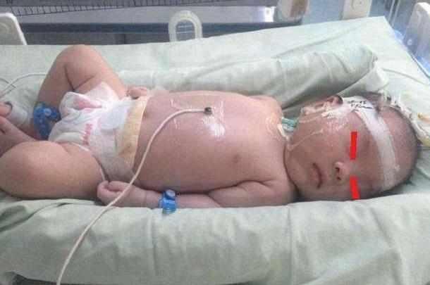 5个月大的宝宝散发异味, 赶紧送往医院, 事后婆婆打了宝妈