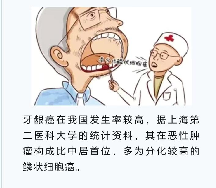 牙癌在医学上常指牙龈癌，是口腔恶性肿瘤。它产生的原因可不少。不良生活习惯是重要