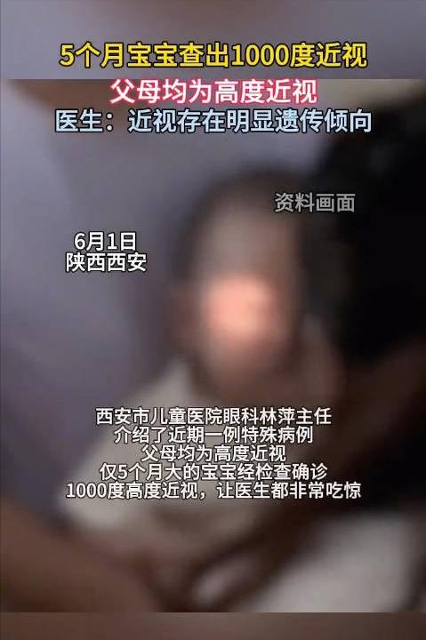 5个月大的婴儿，近视1000度。说实话，看完这个新闻感觉有点离谱5个月的宝宝