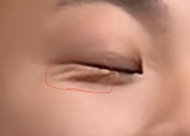面相一则：[并不简单]男士笑起来眼下有（如图）此纹路，此为子孙缘分深的意思，人比