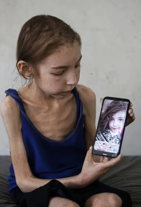加沙女孩对比照，撕开残酷真相