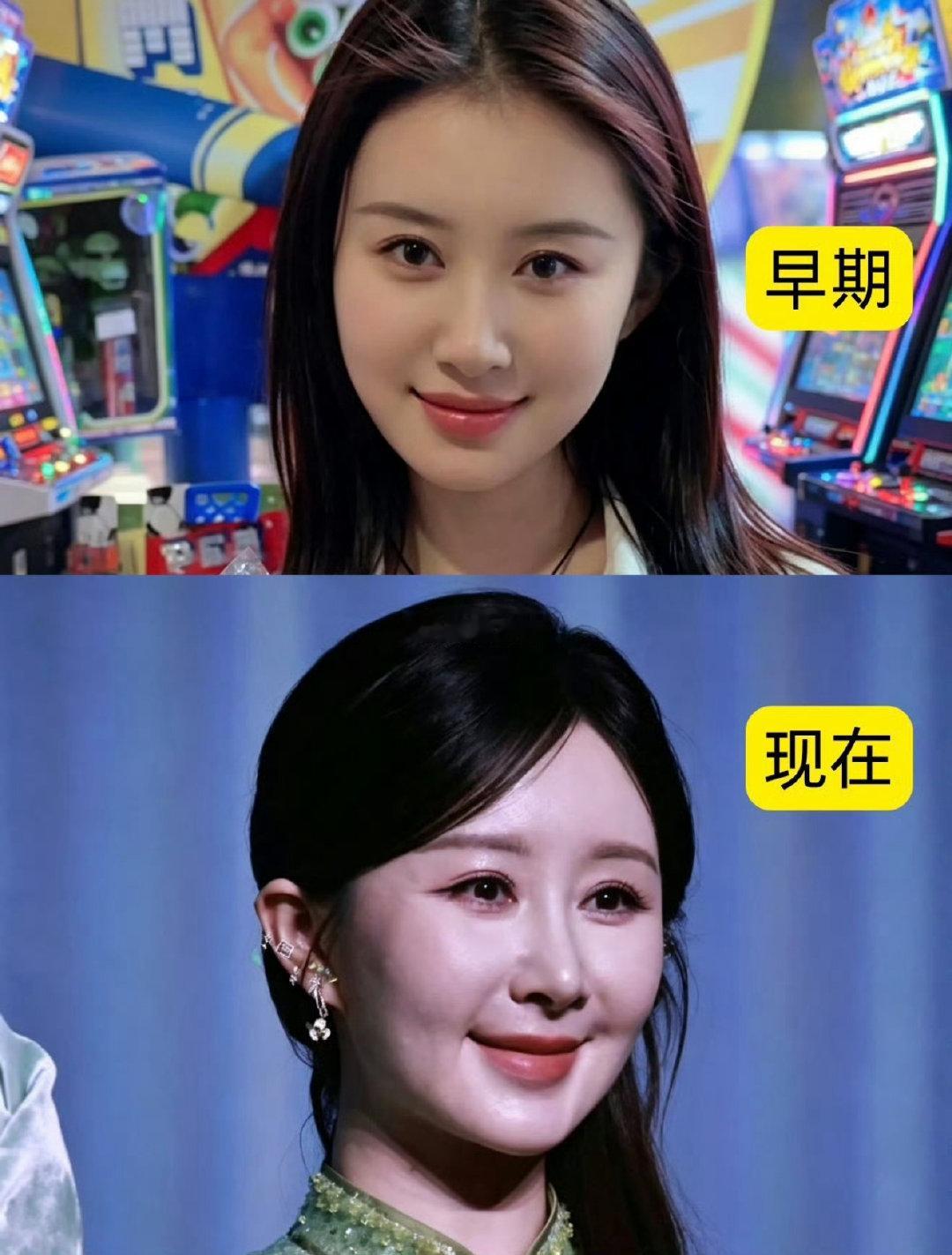#舒畅脸#已经38岁了，维持的挺好的​