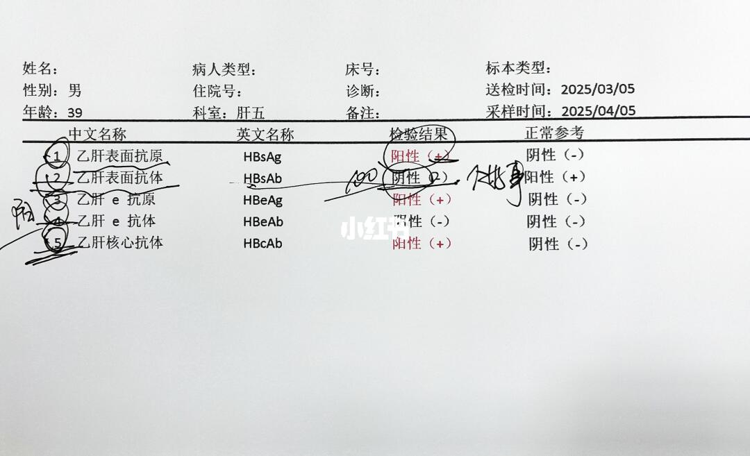 乙肝五项怎么看？其中这几项阳性是好事！ 乙肝五项的第一项 如果是阳性 ...