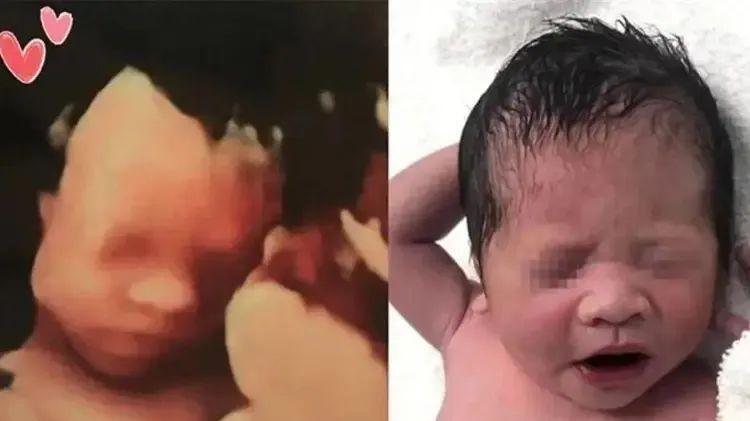 怀孕后,肚子里的宝宝也在努力