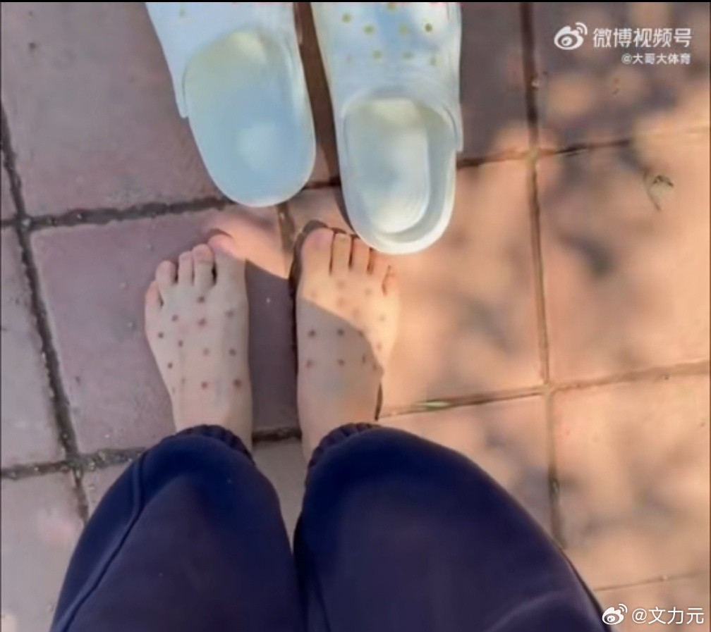 洞洞鞋上岗，但是一定记得穿个袜子，不然就会被晒成洞洞脚[doge]​​​