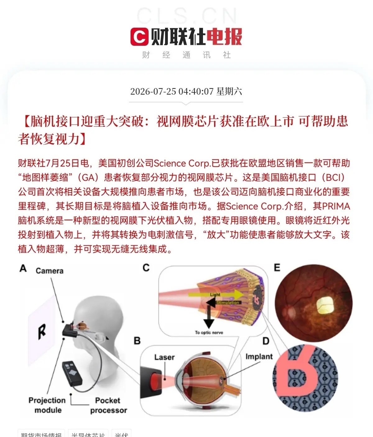 重大消息！重大消息！脑机接口迎来利好消息了，这下好了，满仓脑机接口的要乐开花了，