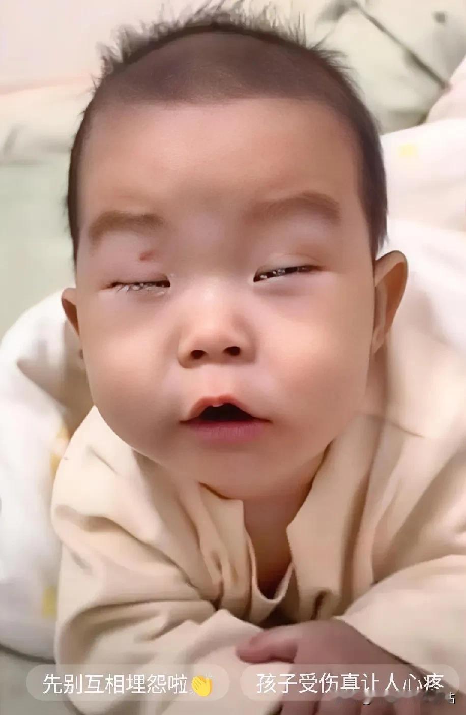 孩子摔成憨包！妻子把责任推给婆婆，自己好像一点责任也没有一样！痛心呀！这天孩