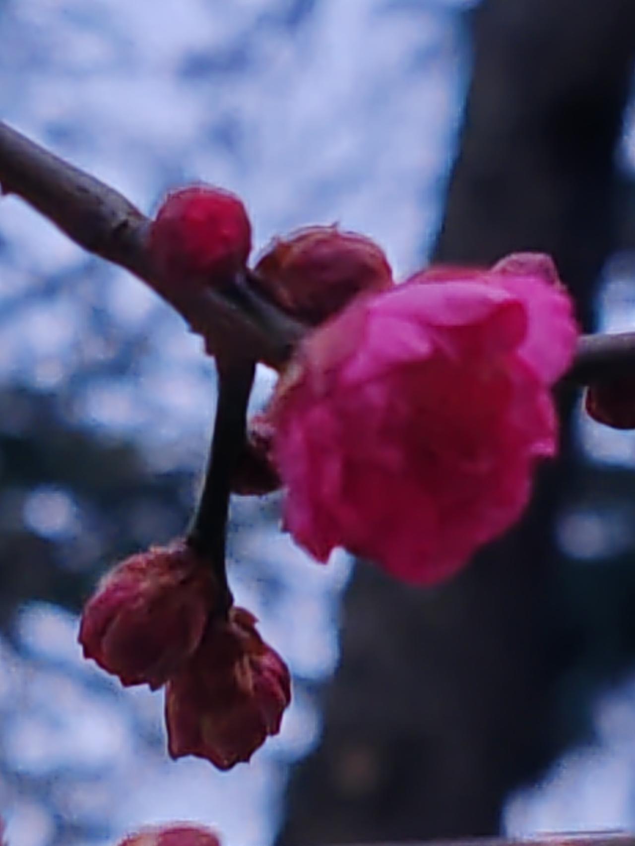 小毛病，几百块钱的事。去医院皮肤科看看，除掉就是了。心里膈应的事就别等。除了它后