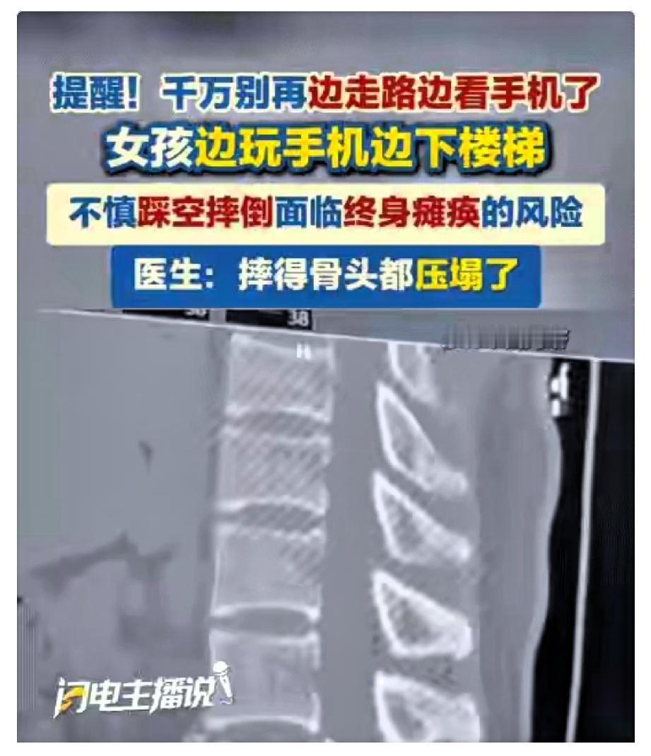 3秒！毁了一辈子！在生活中，很多人都有一边走路一边看手机的习惯，甚至觉得这样