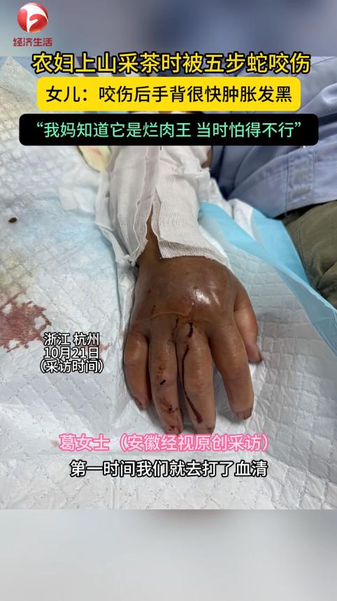 “悲剧还是发生了！”浙江杭州，一女子上山采茶叶时，忽然感觉手被扎了一下，低头一看