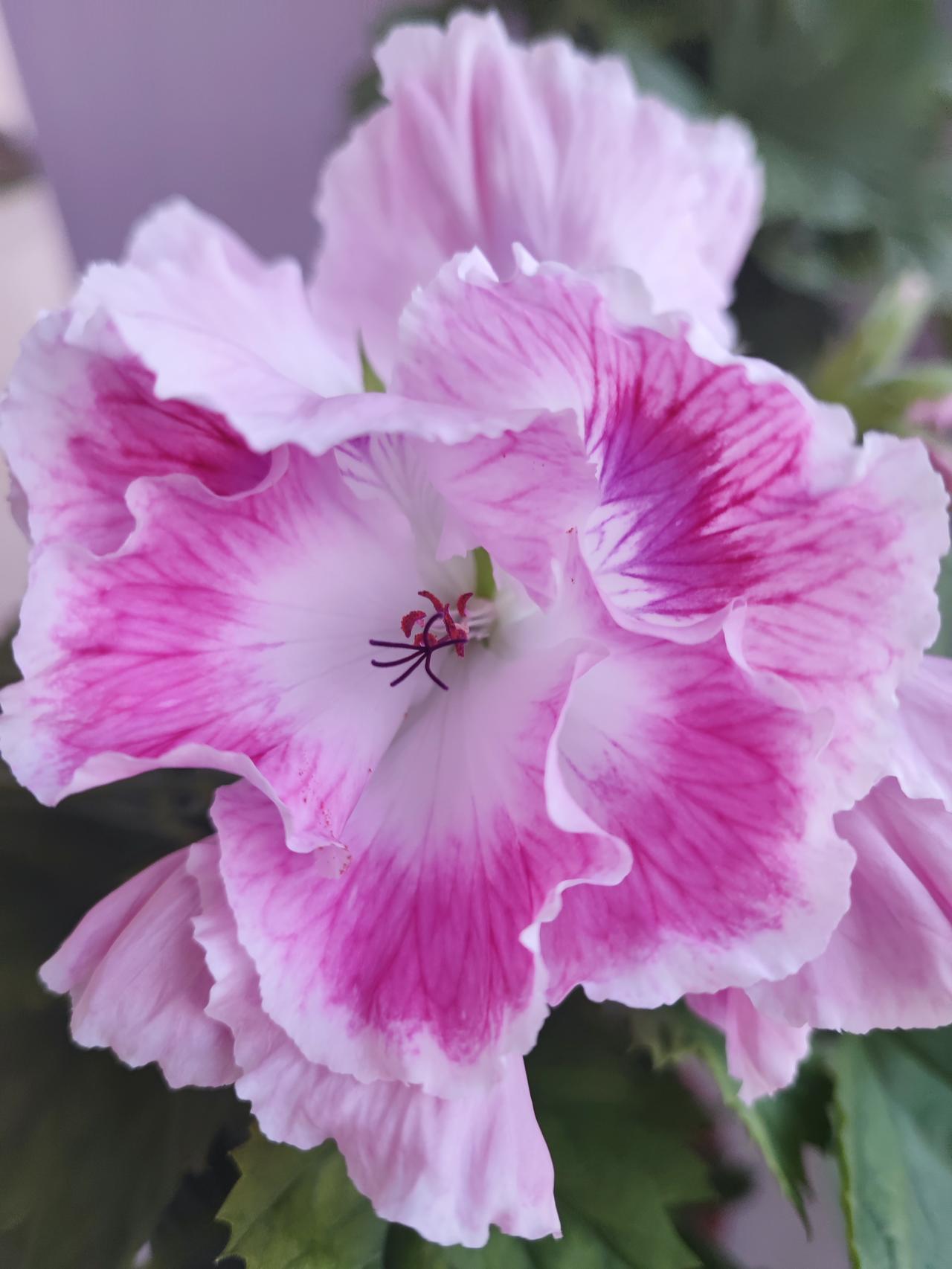 有病别耽误朋友眼睛充血很严重，找熟悉的眼科大夫问问，熟人也是为了给省点钱吧