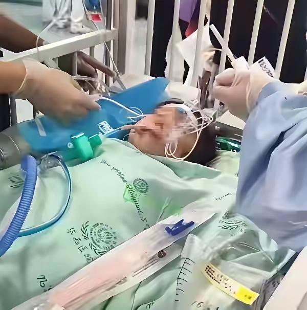 没想到三岁女童面部被咬原本可以避免。网友最近爆料，我们才知道四川被狗咬伤面部