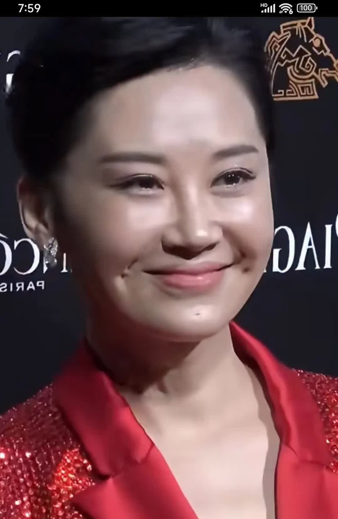 第一眼没看出来是谁，第二眼才看出来这是许晴。好家伙，这是往脸上注射了什么