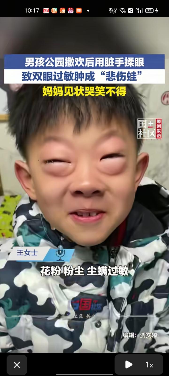 3月7日，山西大同。孩子妈妈王女士分享一段视频，儿子对花粉、粉尘、尘螨过敏，这次