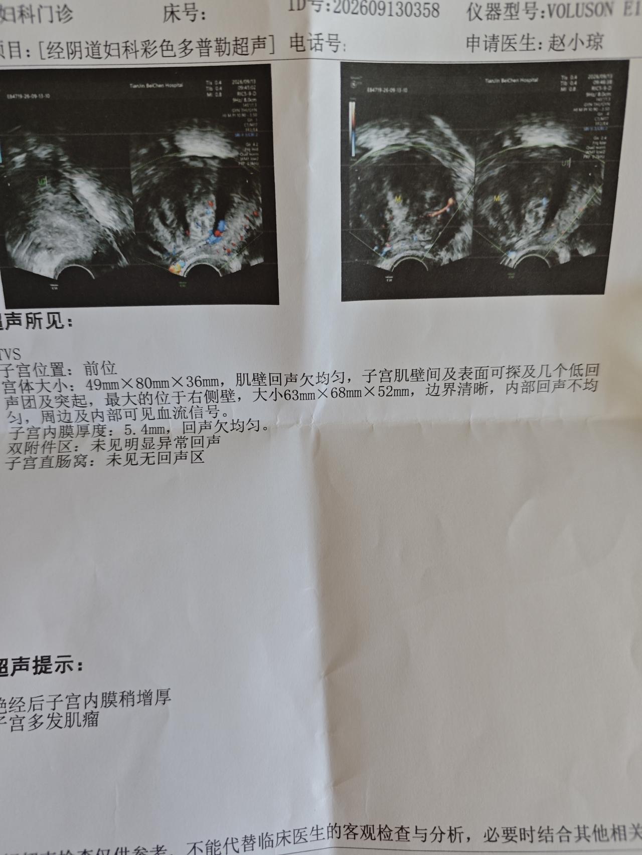 真是愁死人了，都六十多岁了，这个子宫肌瘤还没有萎缩。今天又去医院做了彩超检查