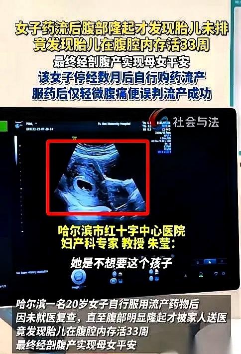 我跟你说个事儿，哈尔滨一个20岁的姑娘，吃药想把孩子打掉。因担心家人责备，