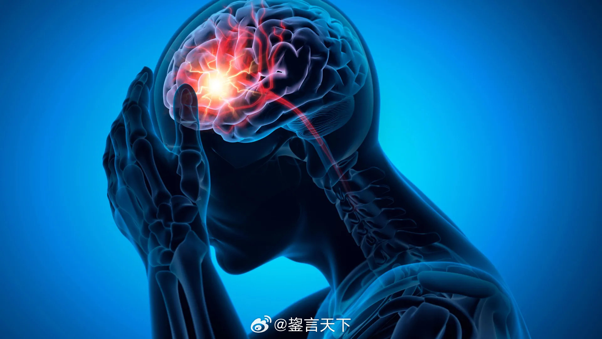 缺血性脑中风的真正原因最新发表于《Circulation》的一项研究发现，一种