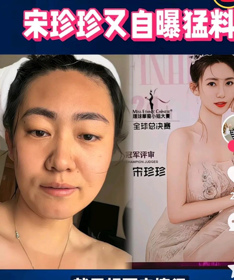 宋珍珍曾经是选美冠军，然后凭美色傍大款。最近她爆料越是有钱人越想白嫖。这个年
