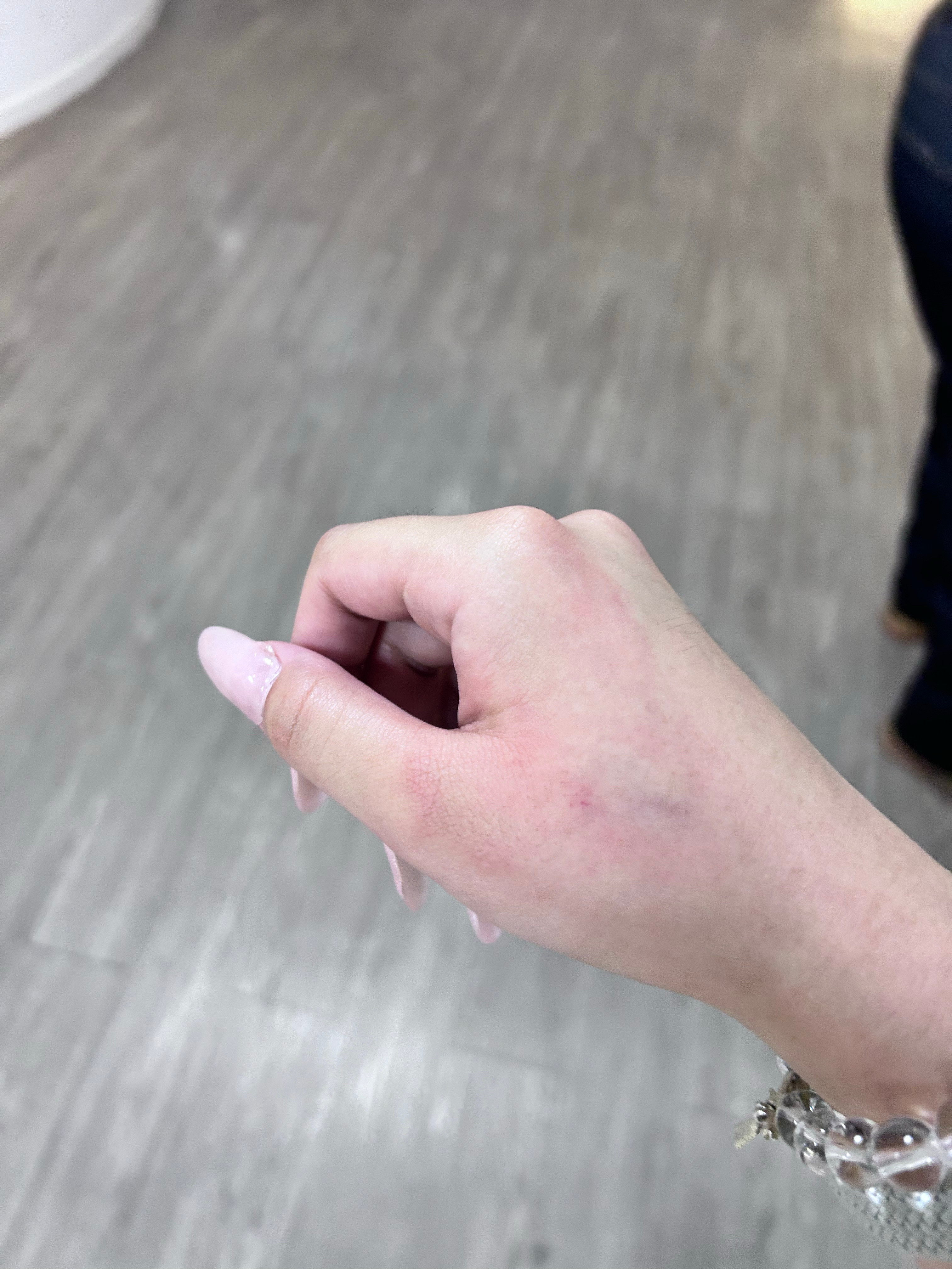 大早上上课手撞门上了疼疼疼 ​​​
