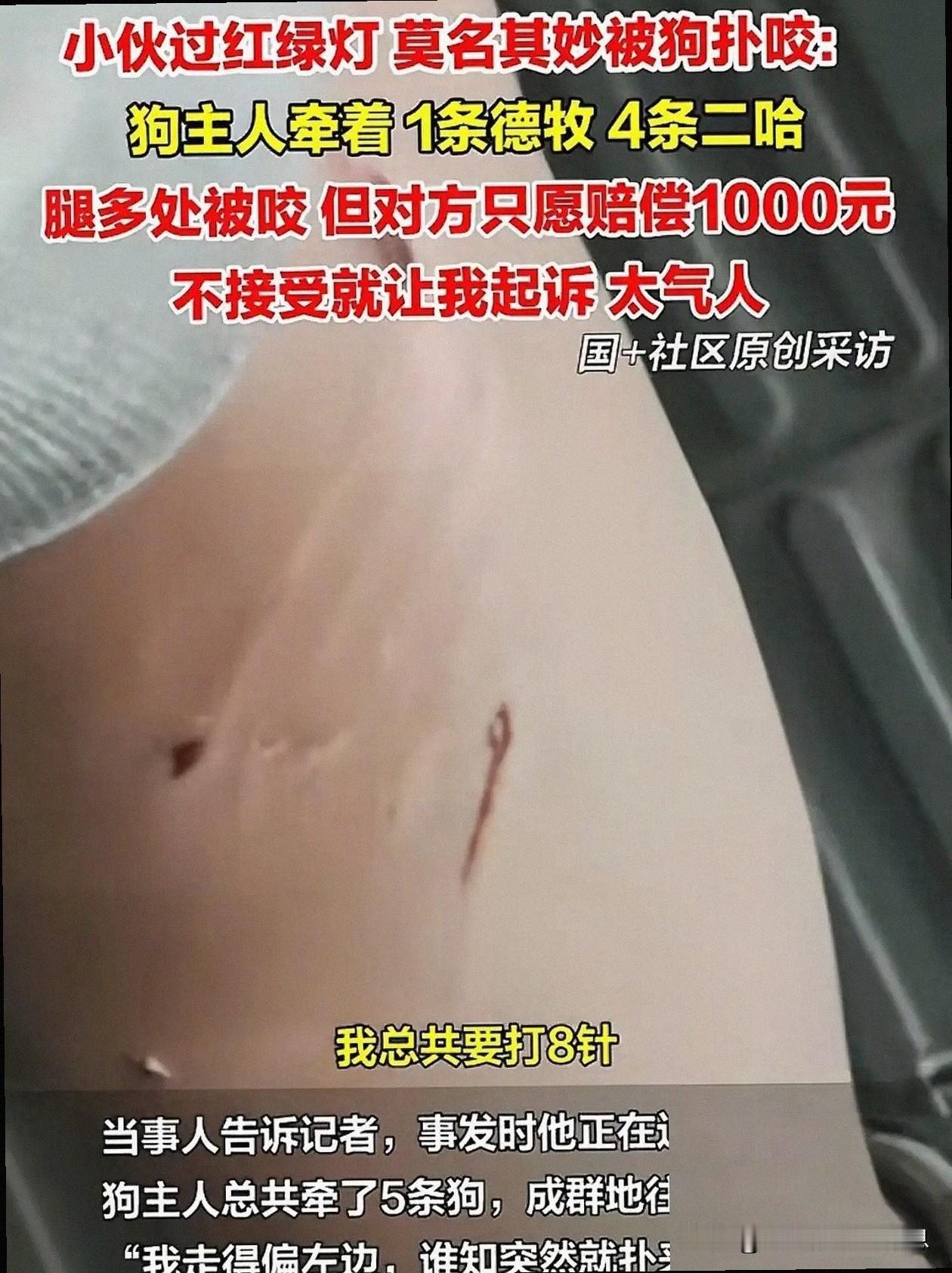 1月27号傍晚，路口等绿灯的小林被一只没拴绳的德国牧羊犬咬伤。德国牧羊