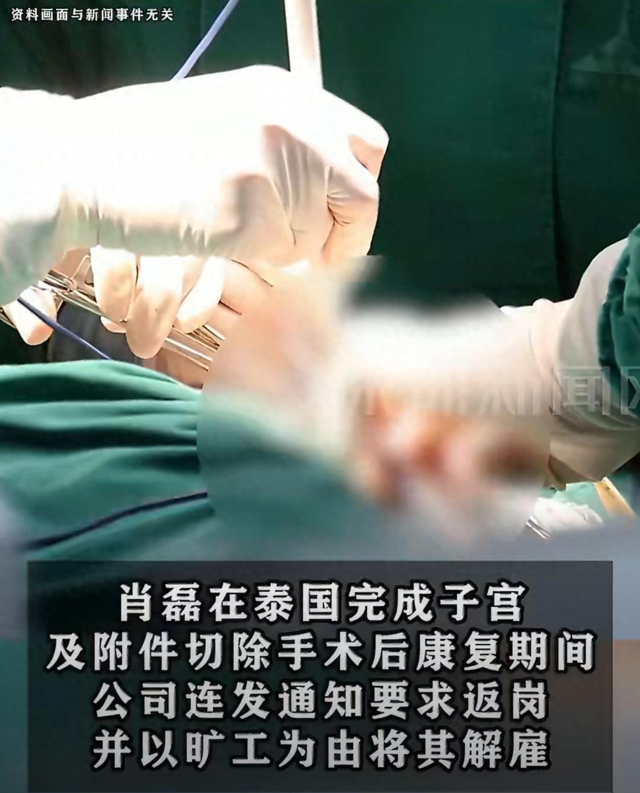 广西南宁，一名女子确诊性别烦躁，就想要去泰国变成男人，但他的病假申请却被公司拒绝