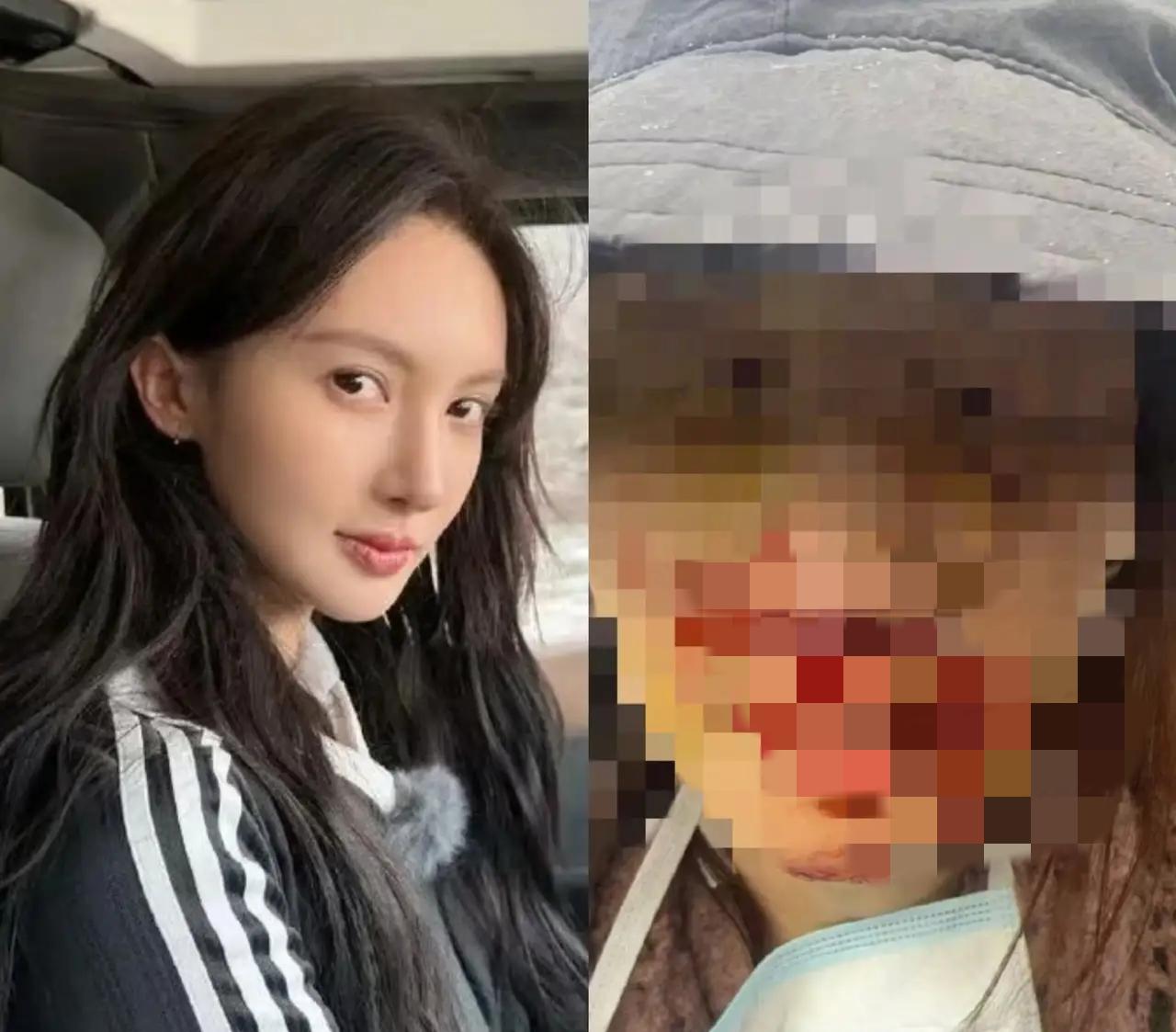 金晨这个事情很奇怪，本来都是去年的车祸，为什么又在这个时间段被翻出来啊？其实