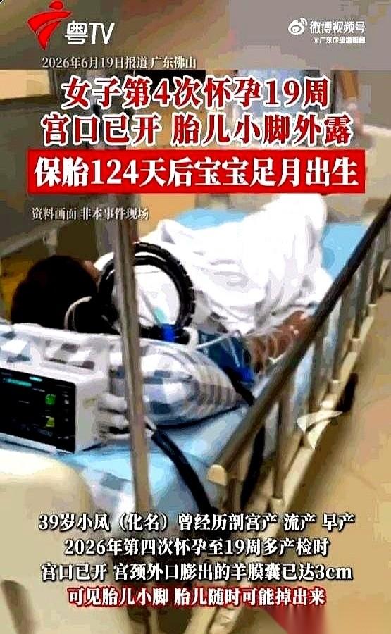 怀孕才4个月，胎儿的脚丫子竟然已经掉出了子宫口。就隔着一层薄得随时会破的透明水
