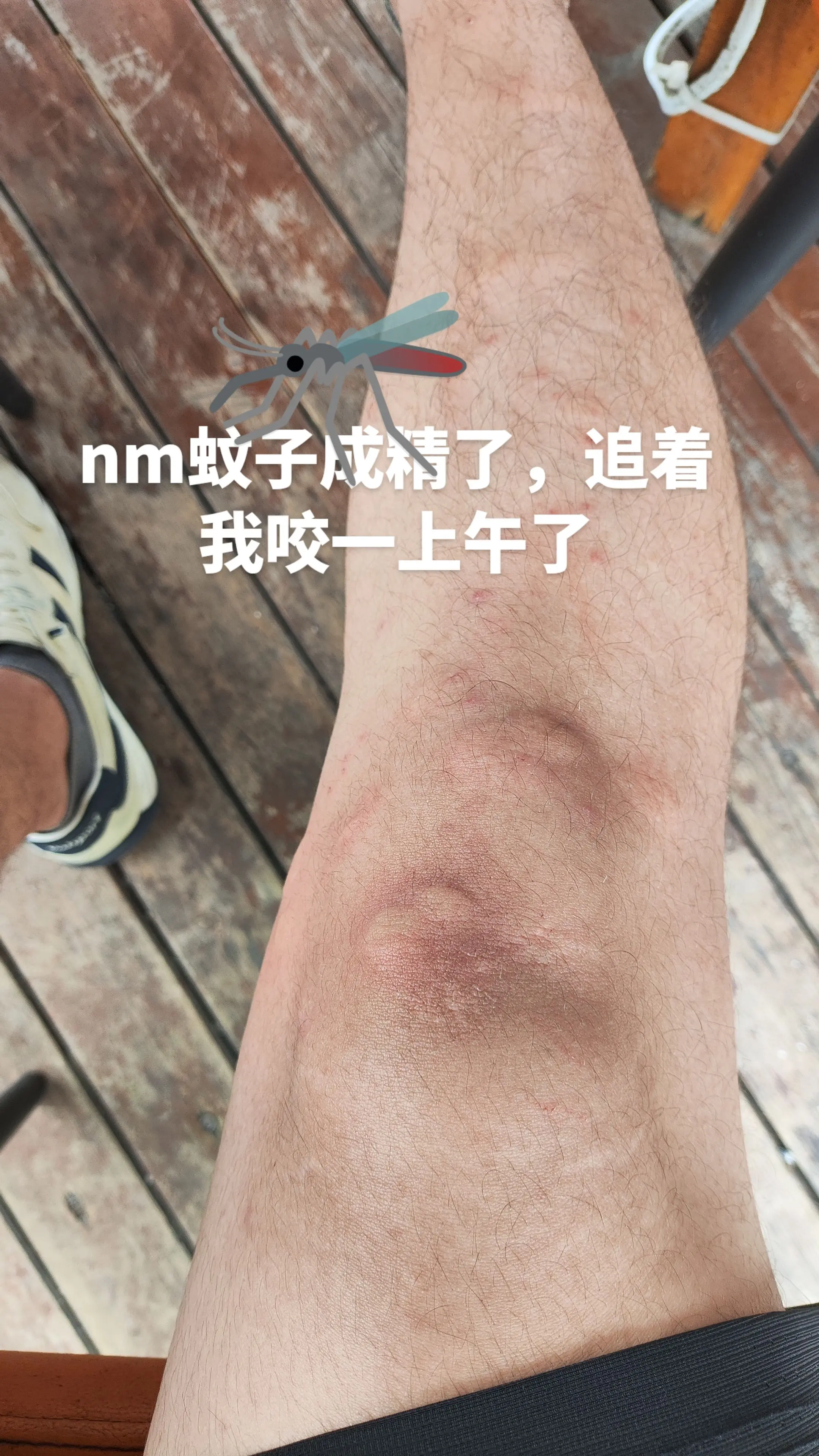 被蚊子追杀是什么体验😣。