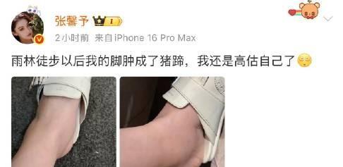 #张馨予雨林徒步脚肿成猪蹄#张馨予在西双版纳每天暴走的结果就是脚肿成猪蹄吗看得