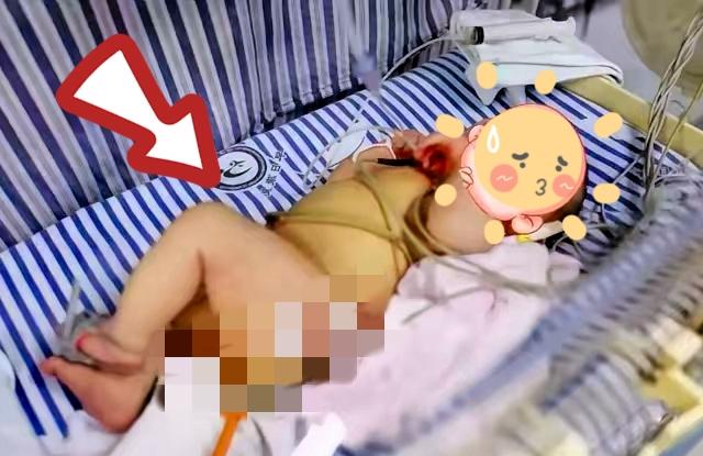29岁产妇顺产下足月男婴，全家还没来得及高兴，接产医生一翻裤裆当场愣住：孩子屁股