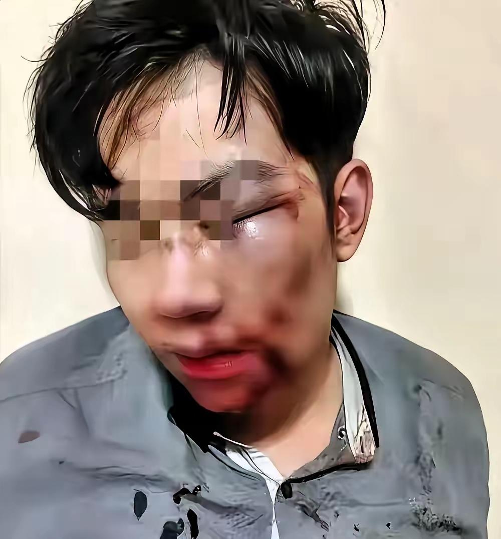 远嫁的姑娘，真的不能没有娘家撑腰！女子远嫁后，丈夫仗着娘家远，长期对她家暴。