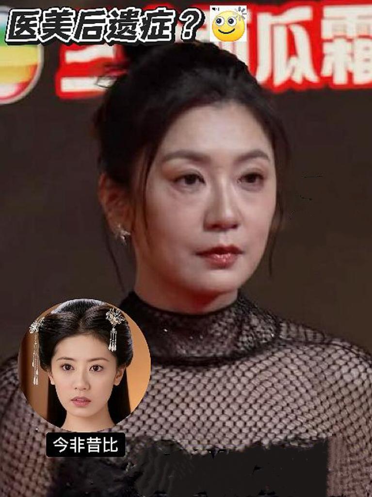 镜头中51岁的贾静雯表情僵硬，目光呆滞，笑容牵强，难道是割眼袋翻车所致？之前俊目