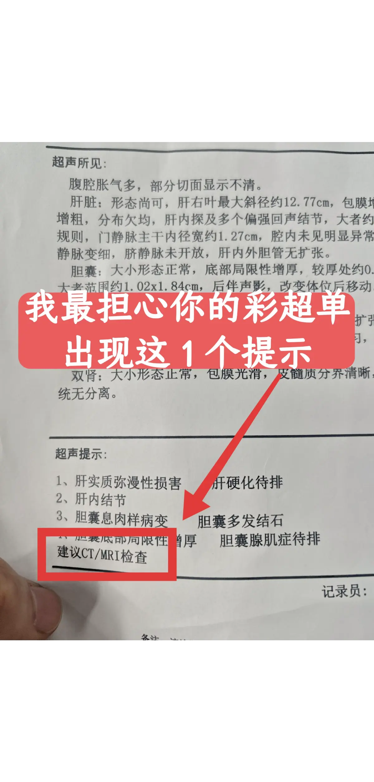 说实话，患者如果查出乙肝、肝纤维化、早期肝硬化，我不是特担心，因为我为...