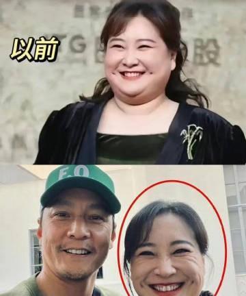 #减肥太猛显老#这是最好的例子吧？