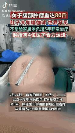 湖北女子丽丽肚里长肿瘤，因没钱拖延5年，肿瘤长到80斤重。腹围149厘米，血管暴