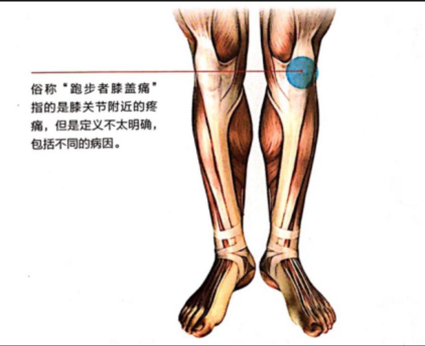 跑步肯定会对膝盖有影响，这个影响是否如很多人想的一样？统计发现跑步膝盖受伤的多数