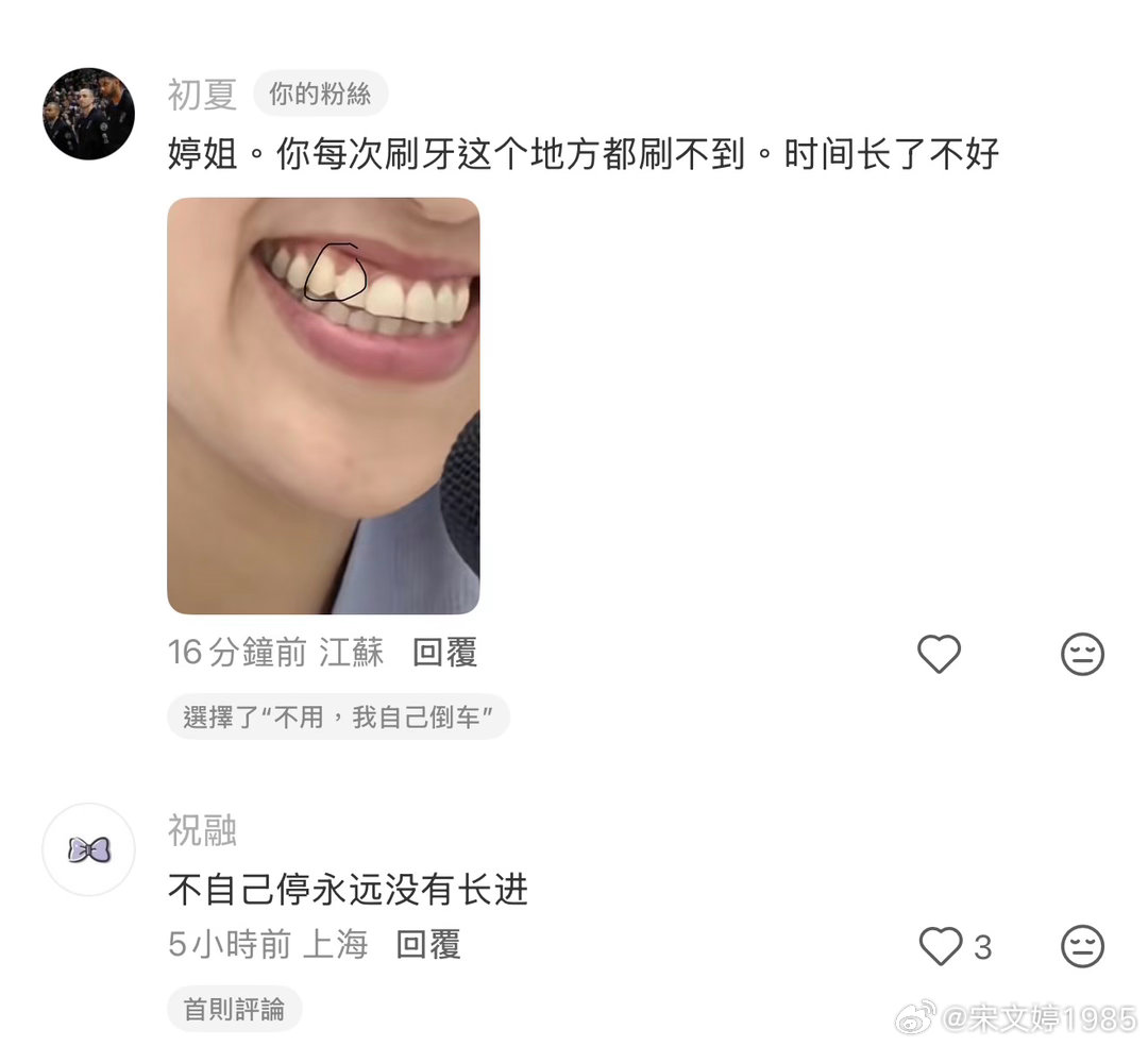 大家帮忙看看这是放大了几倍来看我的牙齿啊