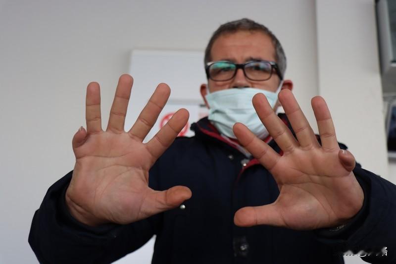 11月20日，安徽宿州刘女士天生12根手指一事引发热议，她还自嘲是“六指琴魔”。