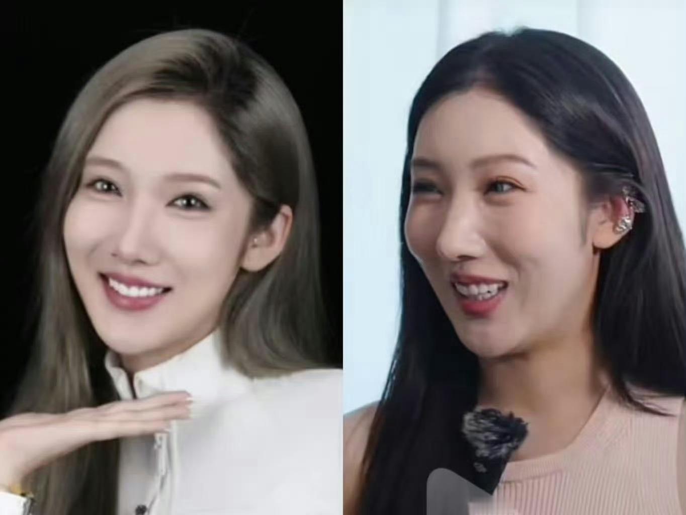 这变化大吗？[思考][思考][思考]都美竹医美​​​