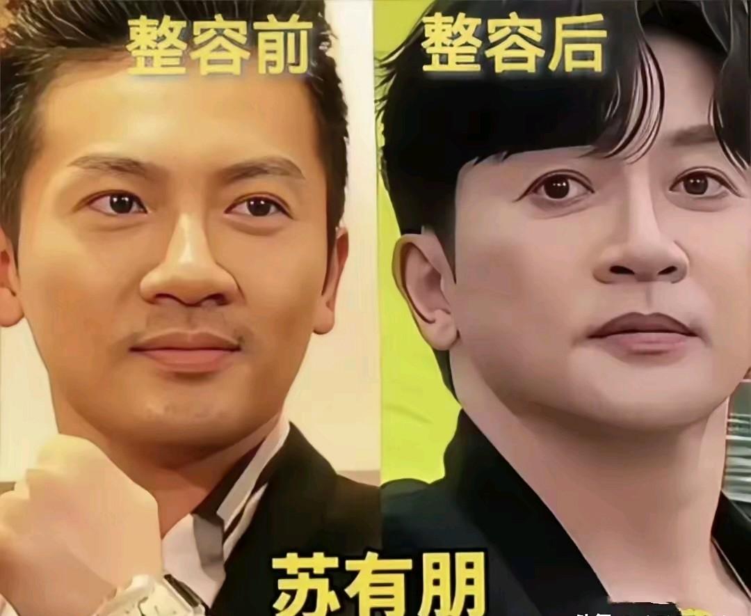 看了苏有朋整容前和整容后的颜值对比，你觉得最失败的是什么地方？苏有朋的颜值也算得