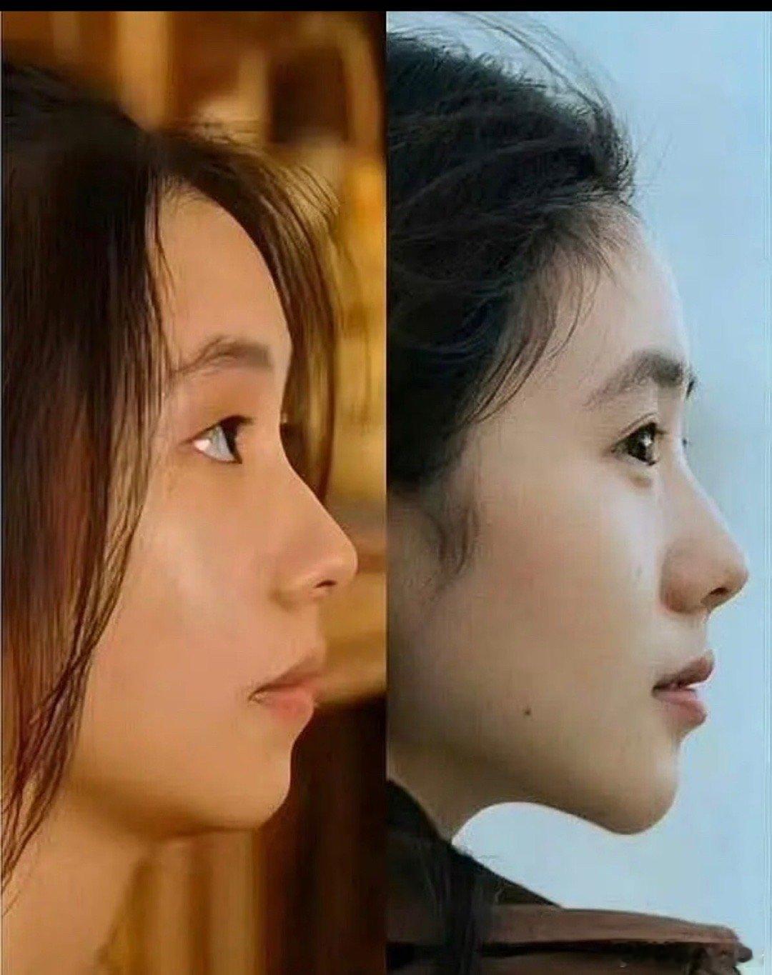 刘浩存的下巴和之前变化好大