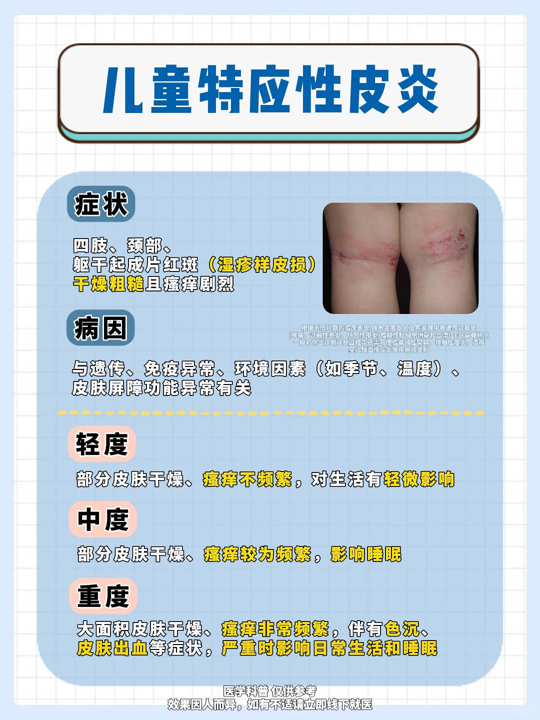 特应性皮炎不含激素外用药合集，记得收藏~。