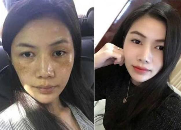 脸上长斑祛不掉怎么办? 3个小妙招, 美白祛斑, 效果看得见