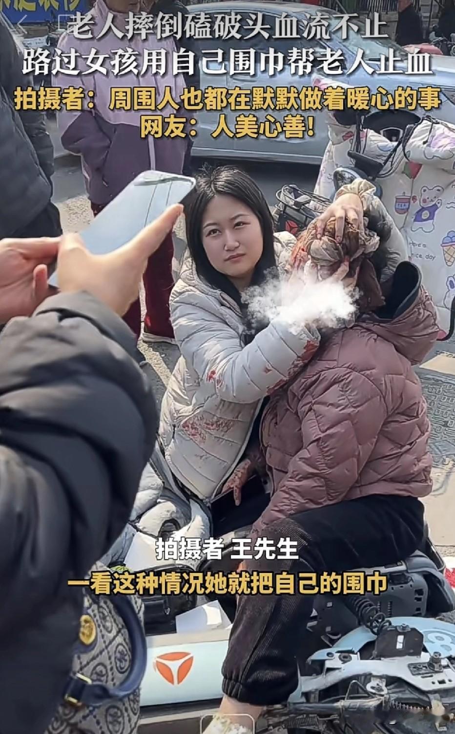 近日，北京一位大妈骑电动车时不慎摔倒了，由于没有佩戴头盔，大妈头部被磕破了血流不