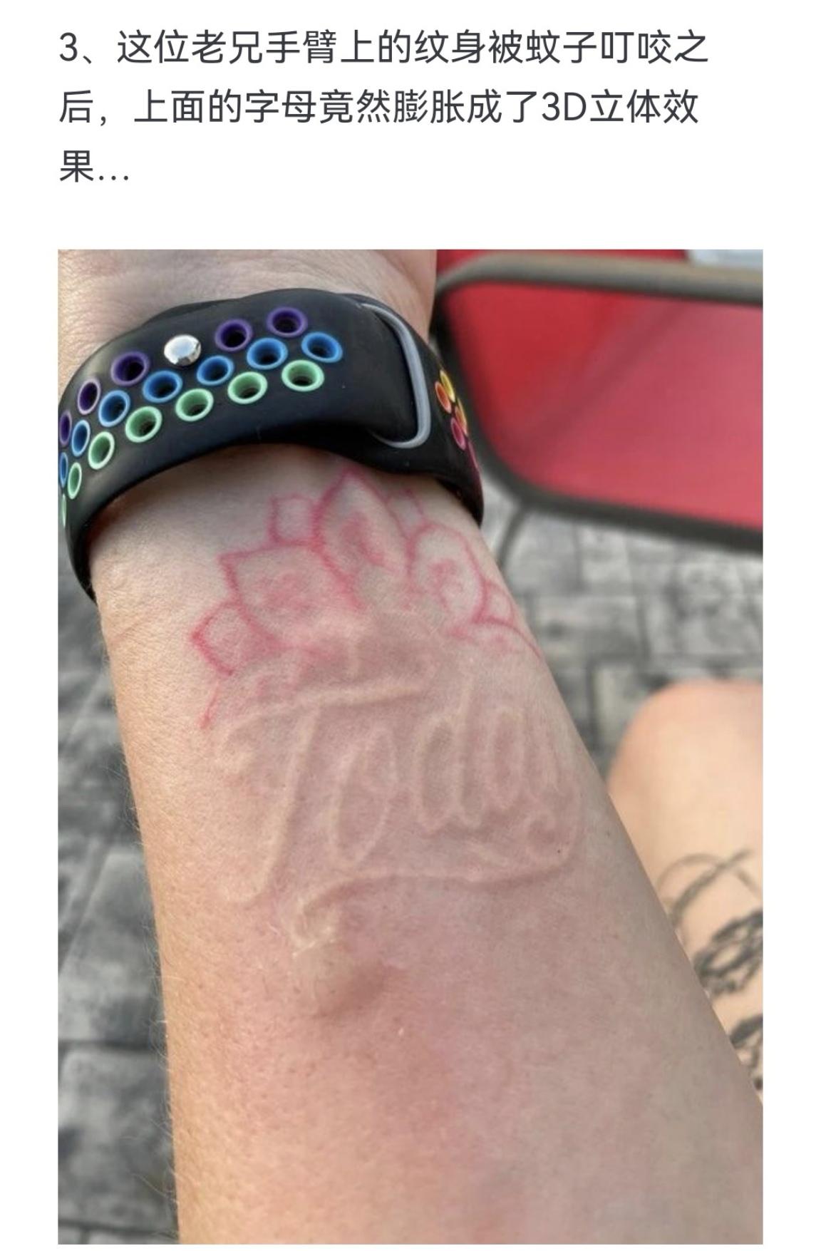 这位老兄手臂上的纹身被蚊子叮咬之后，上面的字母竟然膨胀成了3D立体效果