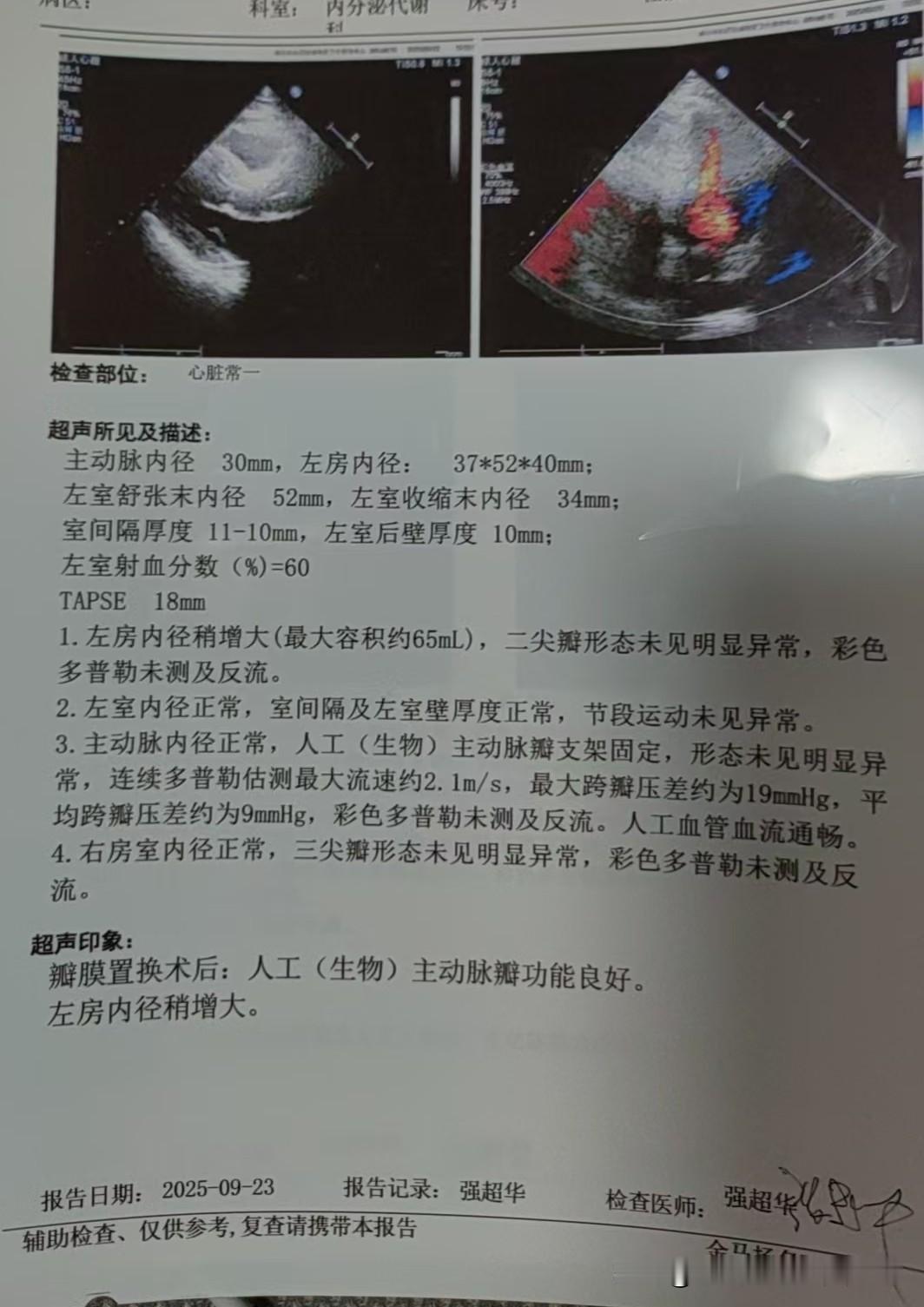 现在基层社区医疗条件是越来越好了，我所在的社区居然能做心超检查了。进入9月，我做