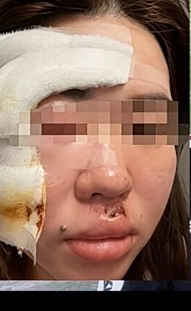 用脸撞榴莲，仅为拒付款湖北女子神操作来了！！这两天一段儿巨狠的狠人视频刷爆