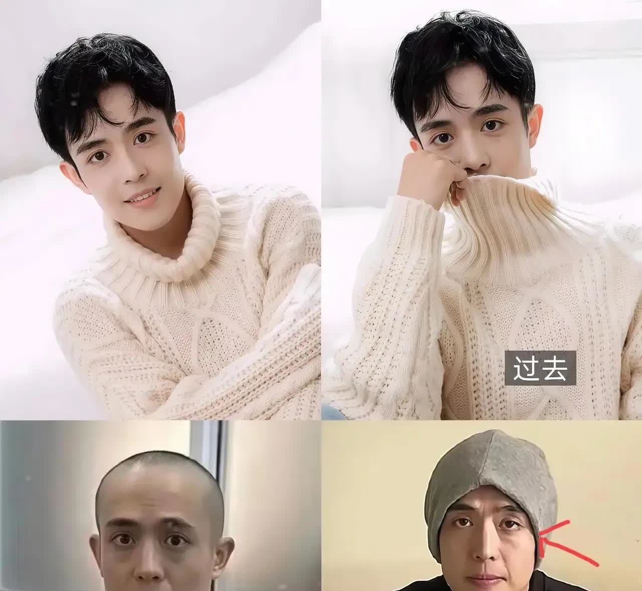 王星上综艺节目都不化妆吗？还是造型师为了配合他节目里设计的人设，类似于受害者妆容