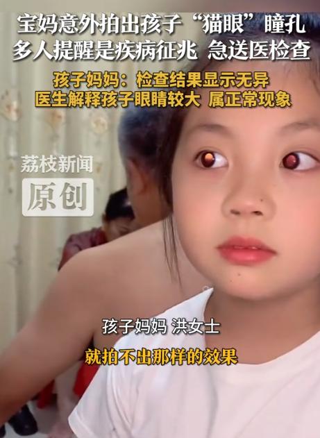 “彻底解释不清了！”湖南，一女子随手给女儿拍视频，竟然发现孩子的眼睛是“猫眼瞳孔