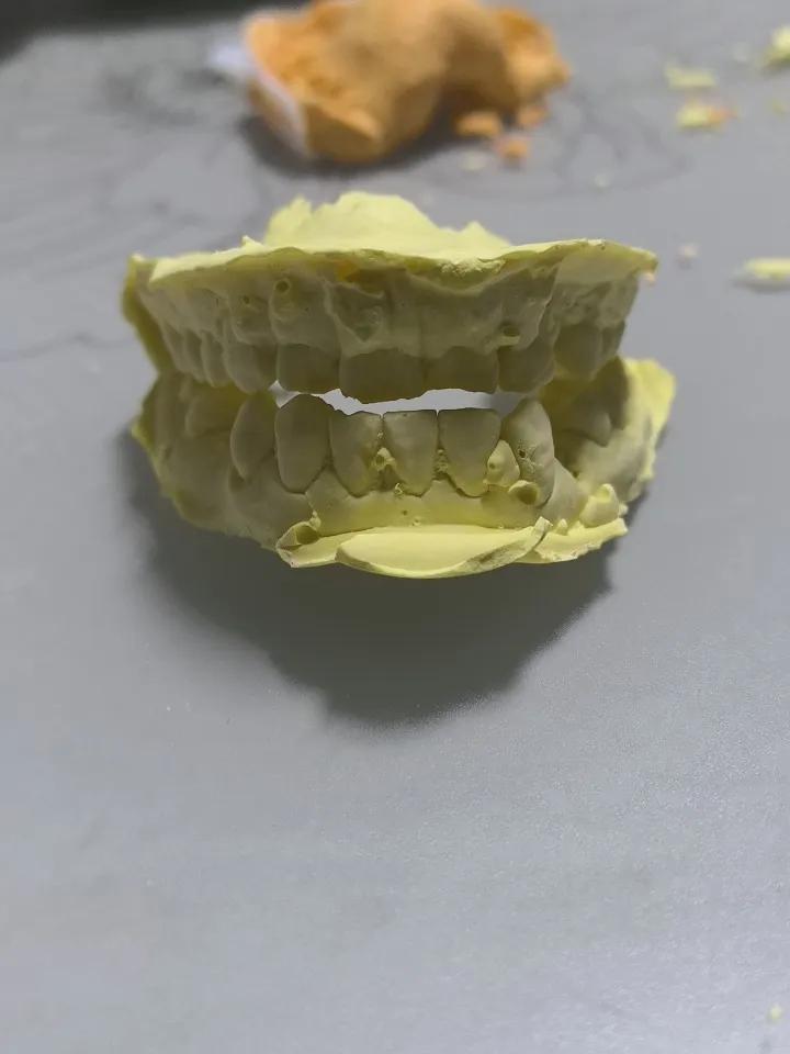 我太难了。制作牙齿模型太费劲了。第一次宣告失败，还得重新来做。谁能明白缺牙的痛苦